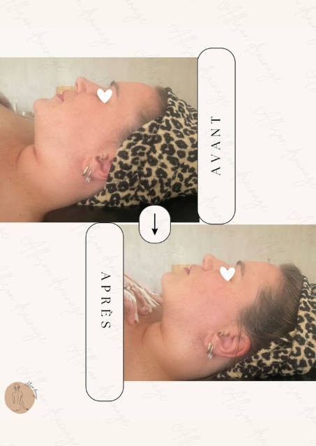 drainage lymphatique méthode renata frança allisondrainage miracle face