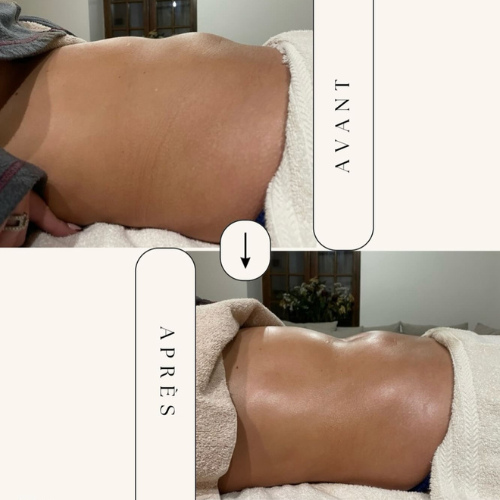 drainage lymphatique méthode renata frança allisondrainage